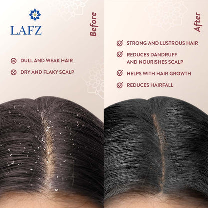 Lafz Essential Onion And Black Seed Hair Oil